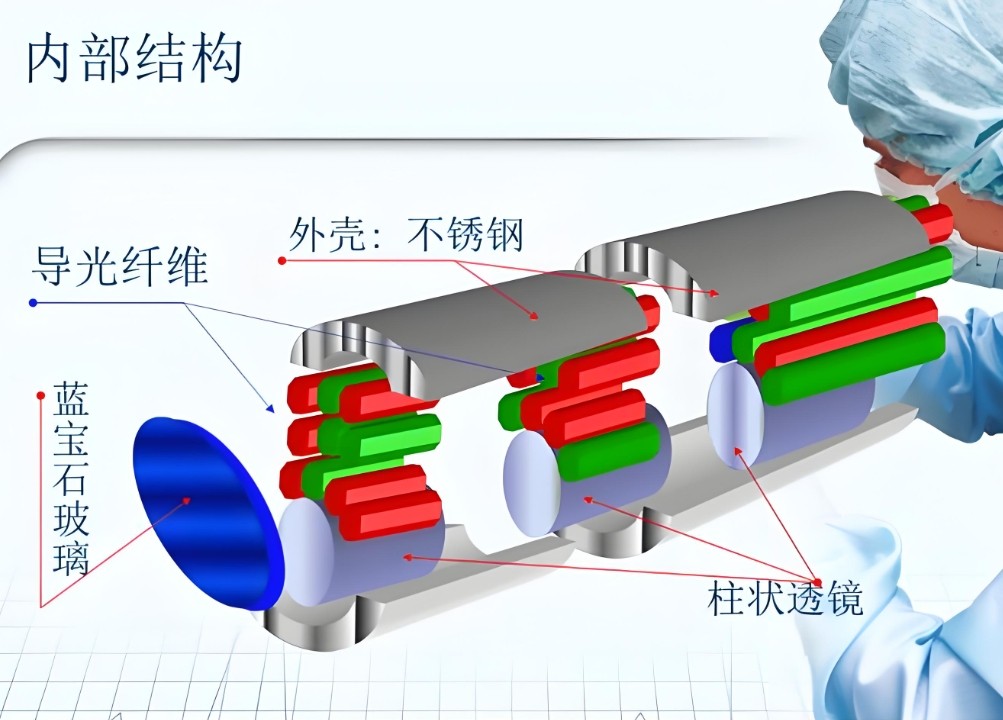 內(nèi)窺鏡硬鏡內(nèi)部結(jié)果